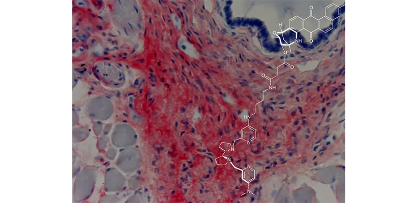 Chemical Biology of Cancer (U1339 / UMR3666) - Institut Curie
